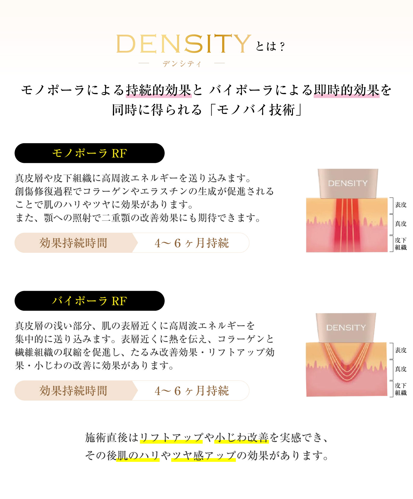 高周波のモノポーラRFとバイポーラRFを同じ電極から発生することが出来る革新的技術