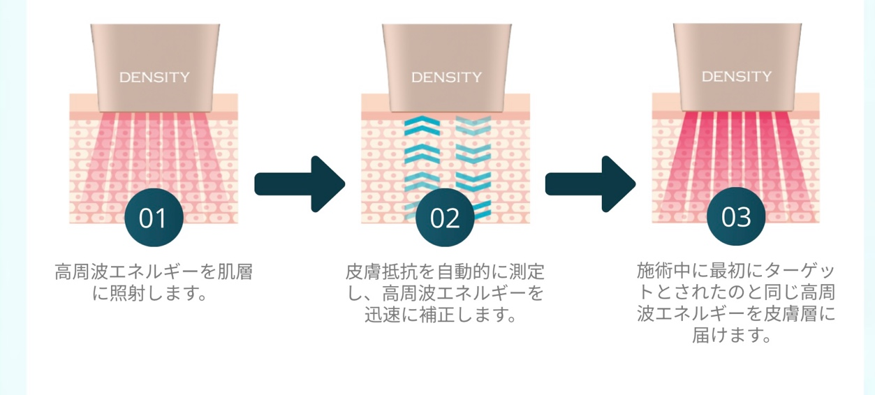 均一な熱エネルギー照射